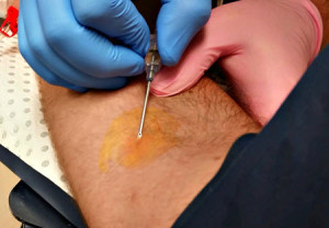 Giving Blood hurts, takes time and has left me tired and was even a bit scary. BUT it gave me a massive sense of satisfaction. Yes, this is my arm at the moment the needle entered me!